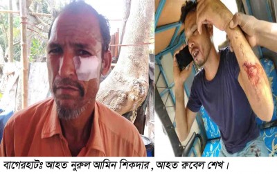 বাগেরহাটে দরপত্র জমা দেওয়ায় ঠিকাদারের প্রতিনিধিকে মারধর, হাসপাতালে ভর্তি বাগেরহাটে দরপত্র জমা দেওয়ায় ঠিকাদারের প্রতিনিধিকে মারধর, হাসপাতালে ভর্তি